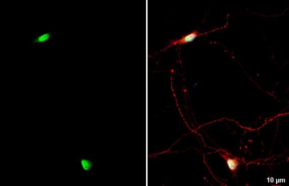 NFIX Antibody