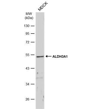 Aldehyde Dehydrogenase 3-A1/ALDH3A1 Antibody