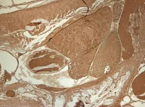 Alpha Actinin 2 Antibody