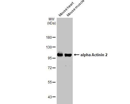 Alpha Actinin 2 Antibody