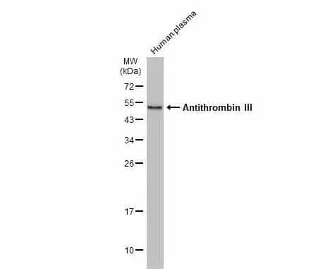 Serpin C1/Antithrombin-III Antibody