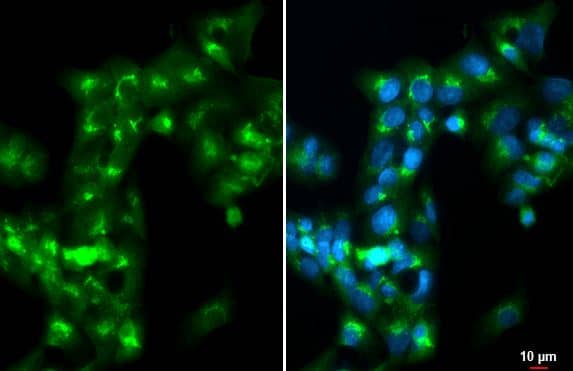 Apolipoprotein A-I/ApoA1 Antibody
