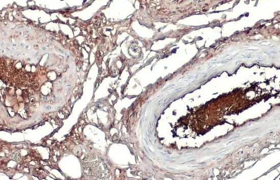 Apolipoprotein A-I/ApoA1 Antibody