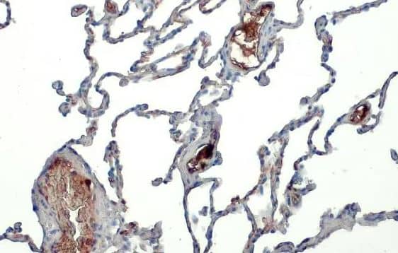 Apolipoprotein A-I/ApoA1 Antibody