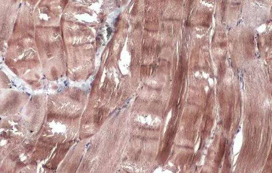 Creatine Kinase, Muscle/CKMM Antibody