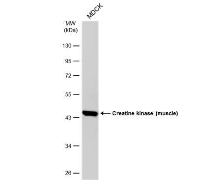 Creatine Kinase, Muscle/CKMM Antibody