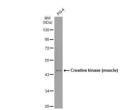 Creatine Kinase, Muscle/CKMM Antibody