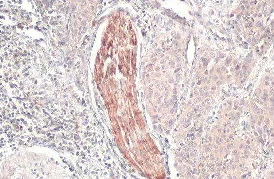 CXCR1/IL-8RA Antibody