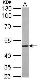 DCP2 Antibody