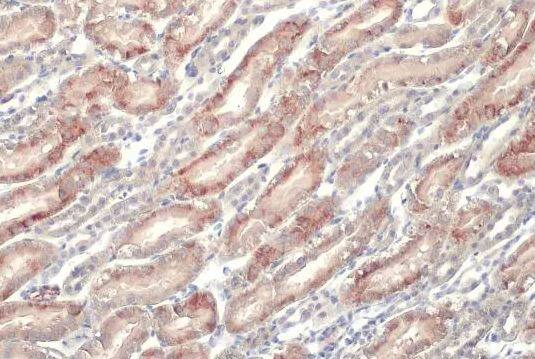 epithelial Sodium Channel alpha Antibody