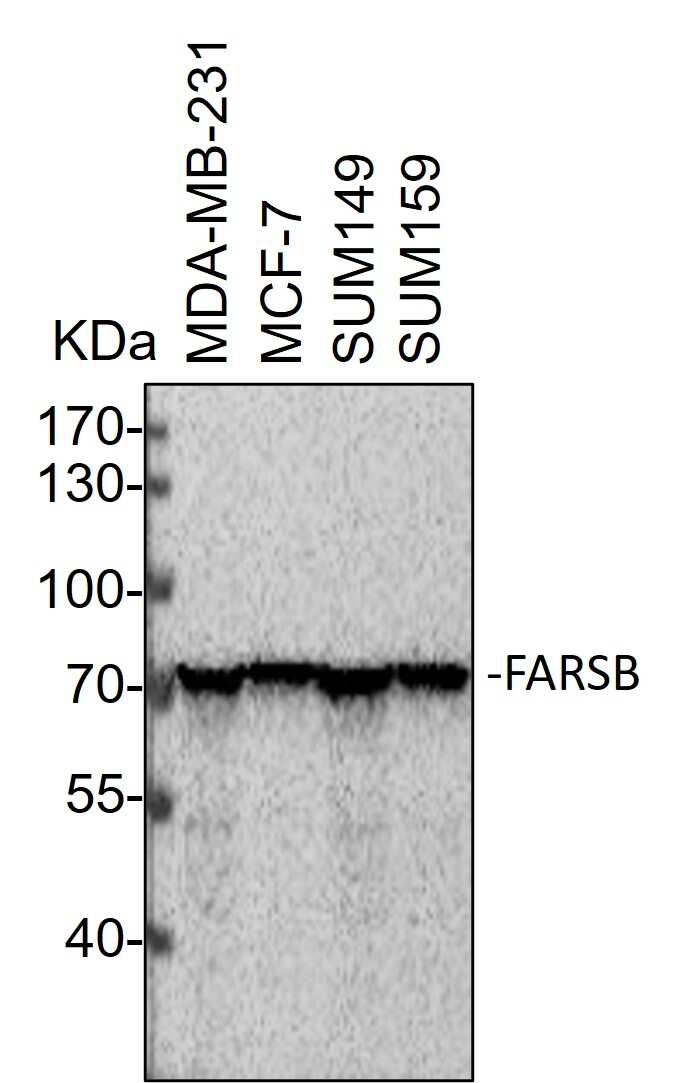 FARSB Antibody