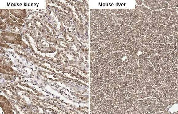 Fumarylacetoacetate hydrolase Antibody