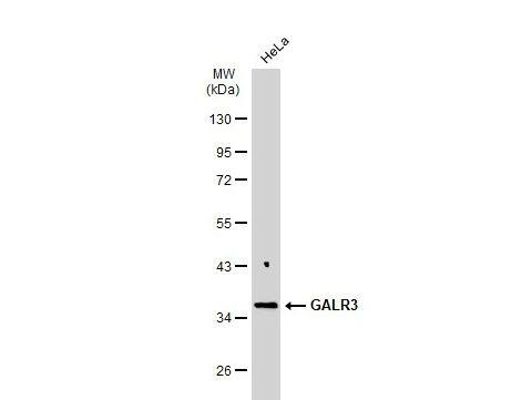 Galanin R3/GALR3 Antibody