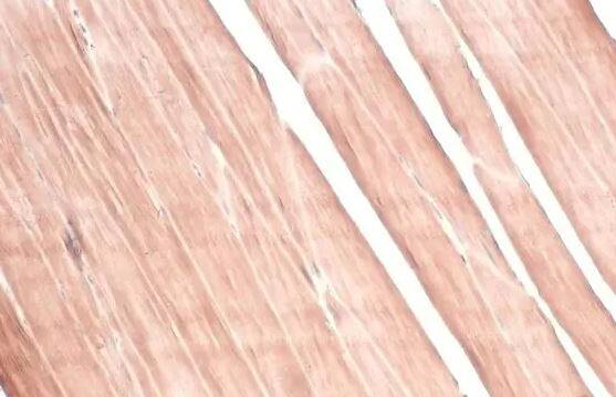 Glycogen phosphorylase, muscle form Antibody