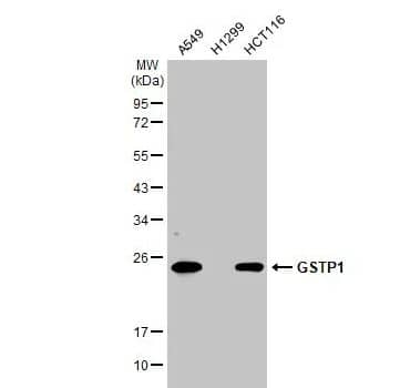 Glutathione S-Transferase pi 1/GSTP1 Antibody