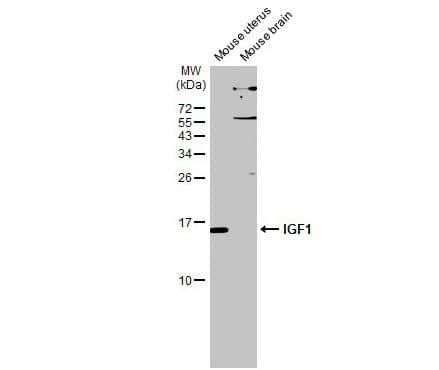 IGF-I/IGF-1 Antibody