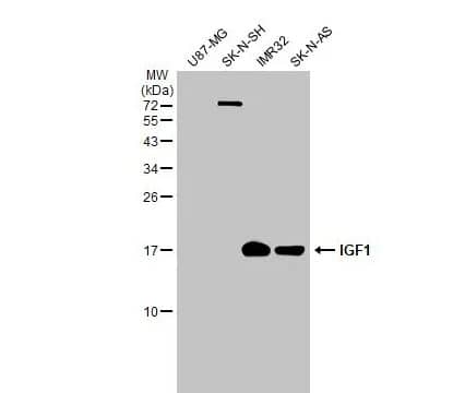 IGF-I/IGF-1 Antibody