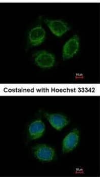 NGL-1/LRRC4C Antibody - BSA Free