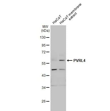 Nectin-4/PVRL4 Antibody