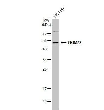 TRIM72 Antibody