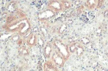 ZNF598 Antibody