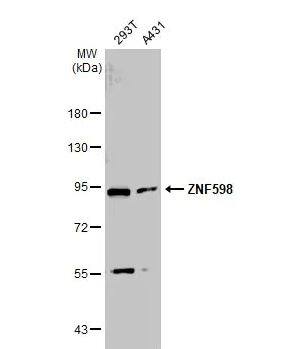 ZNF598 Antibody