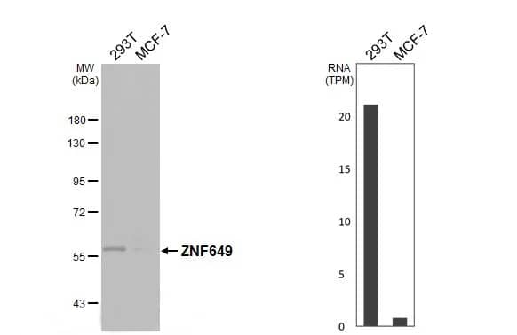 ZNF649 Antibody - BSA Free