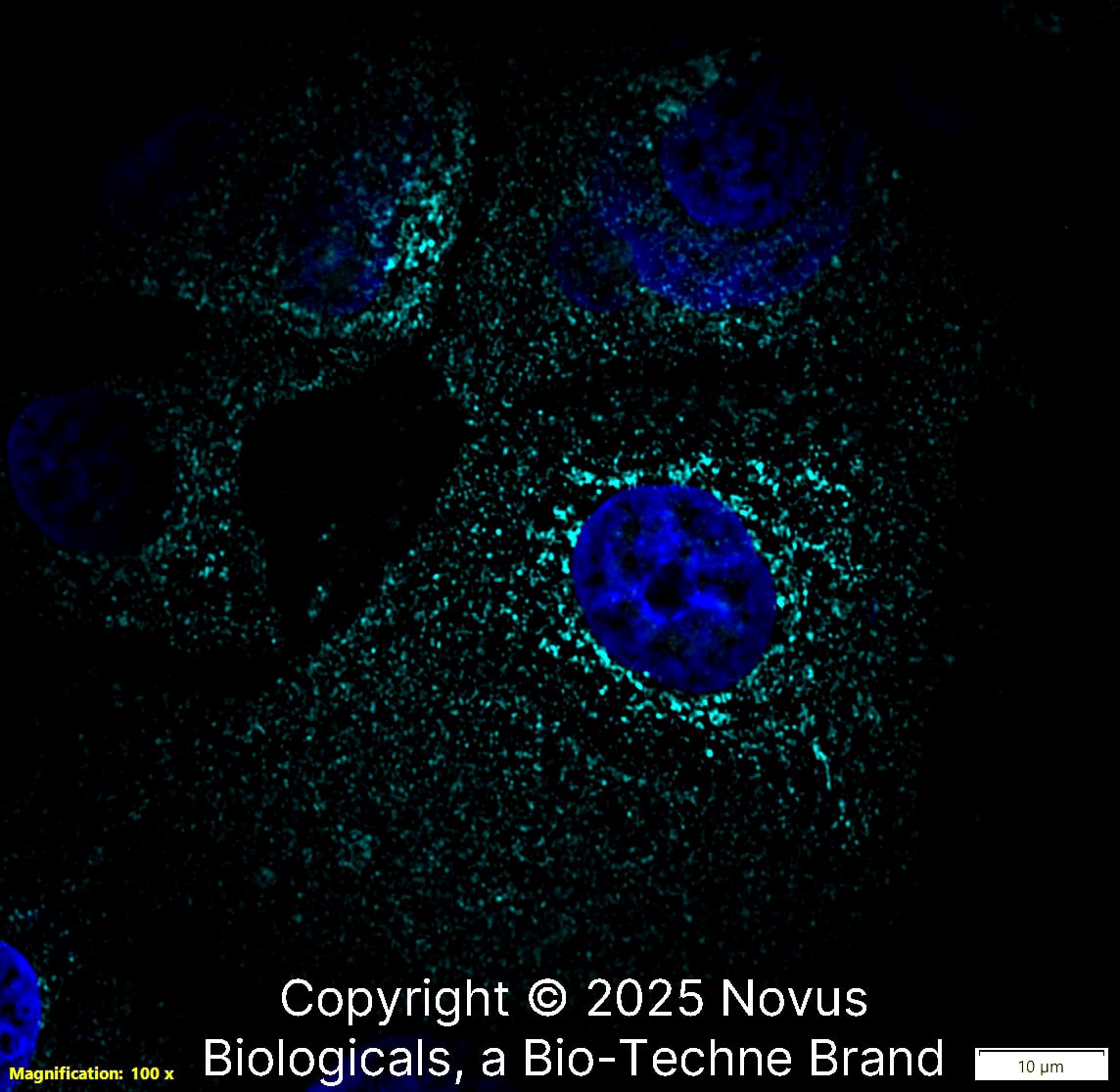 LAMP-2/CD107b Antibody (H4B4) - BSA Free