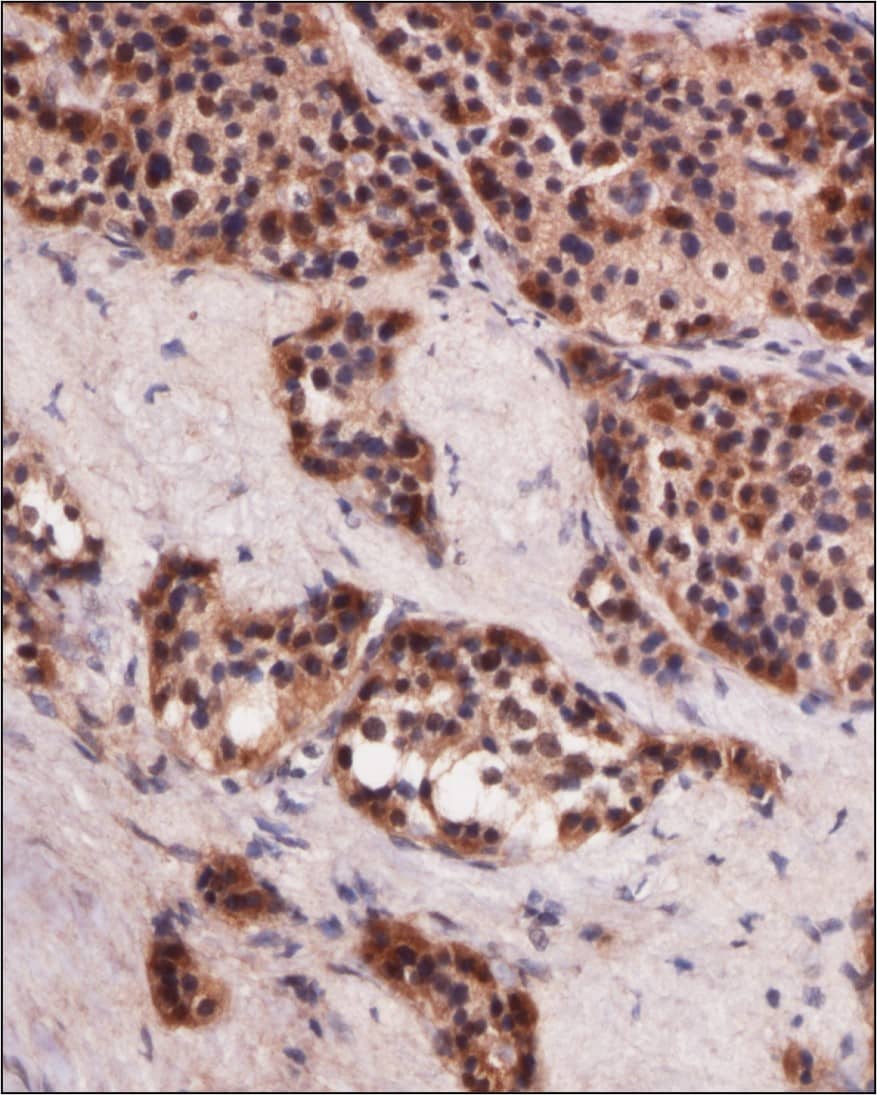 MNX1/HLXB9 Antibody Immunohistochemistry-Paraffin: MNX1/HLXB9 Antibody [NBP2-24691]