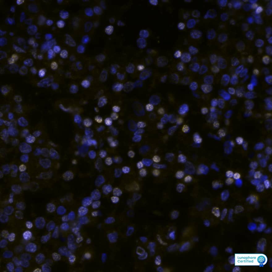 Cyclin D1 Antibody CCND1 in Human Hodgkin’s Lymphoma via seqIF™ staining on COMET™