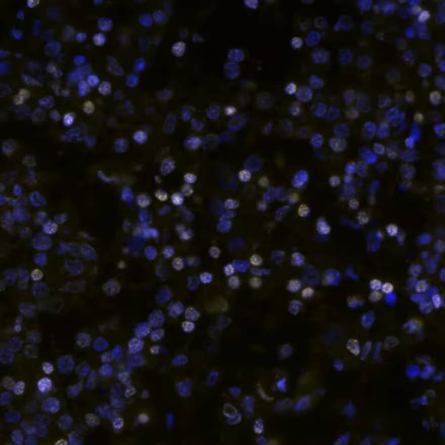 Cyclin D1 Antibody CCND1 in Human Hodgkin’s Lymphoma via seqIF™ staining on COMET™