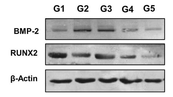 RUNX2/CBFA1 Antibody - BSA Free