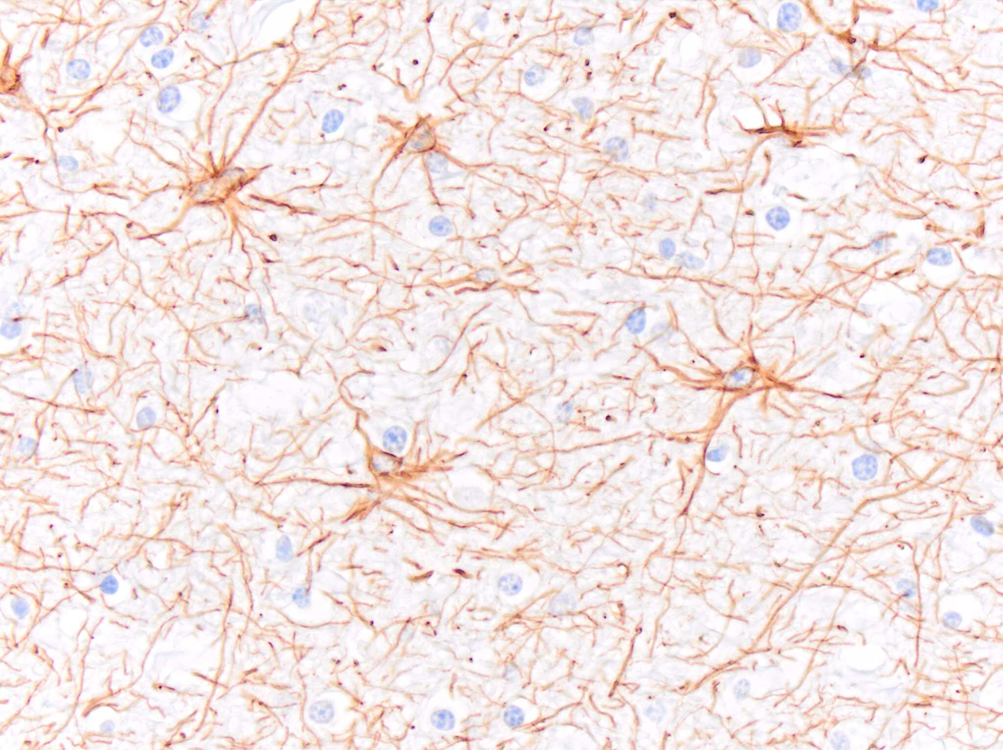 GFAP Antibody (GA-5)