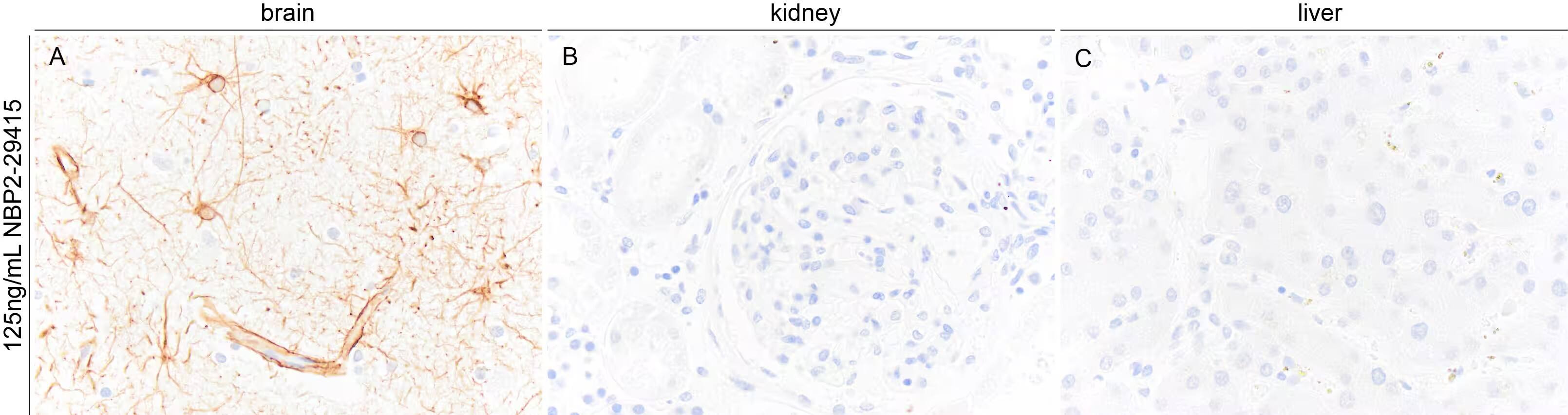 GFAP Antibody (GA-5)