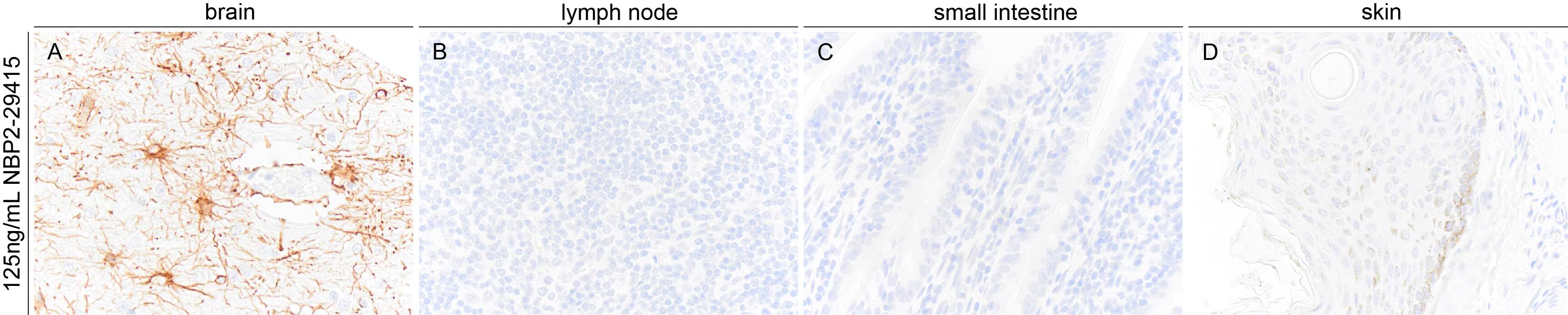 GFAP Antibody (GA-5)