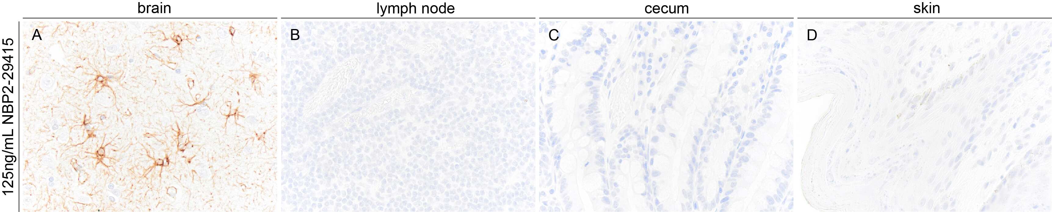 GFAP Antibody (GA-5)