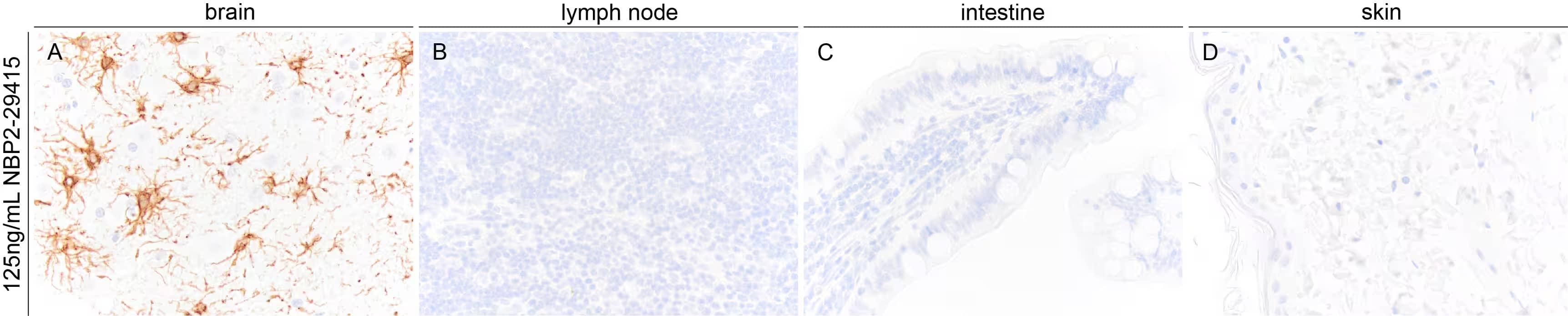 GFAP Antibody (GA-5)