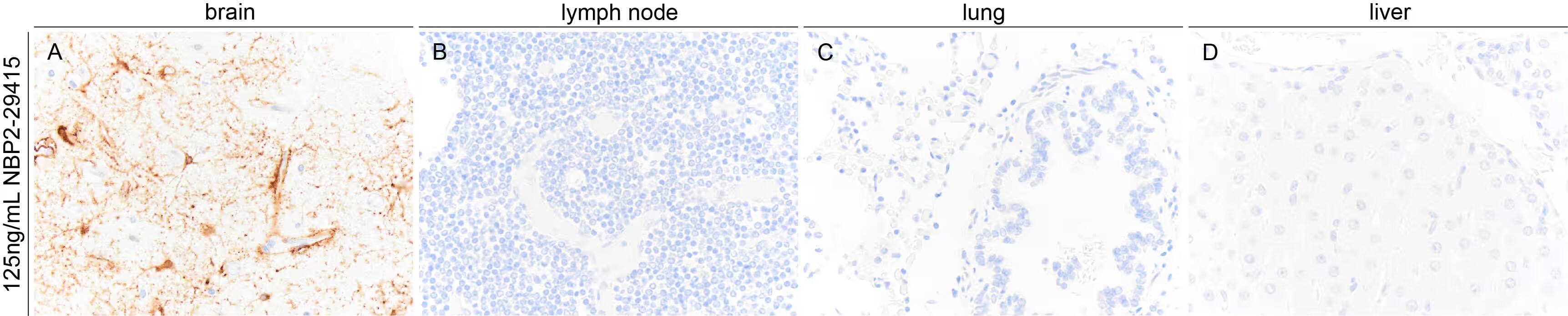 GFAP Antibody (GA-5)