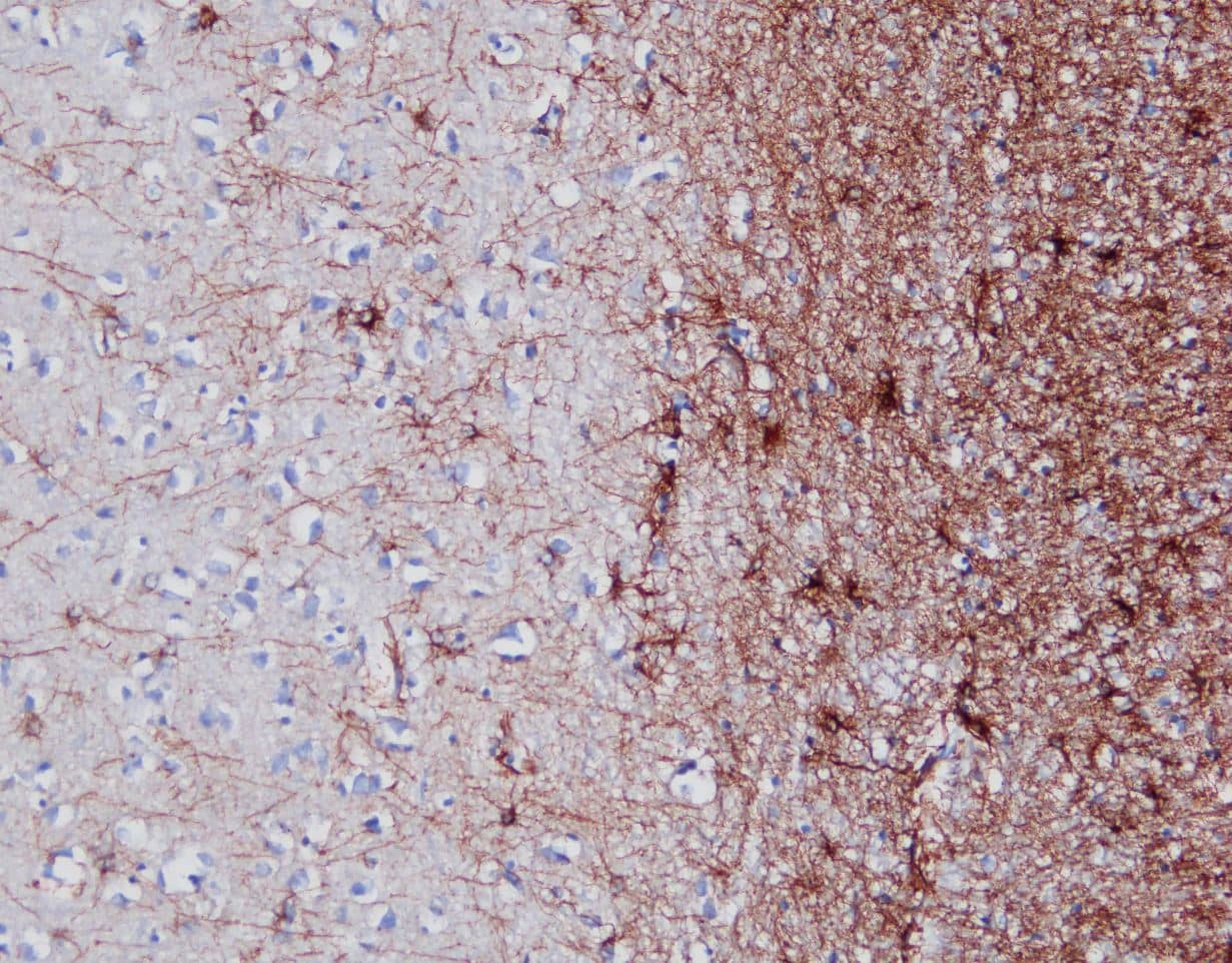 GFAP Antibody (GA-5)