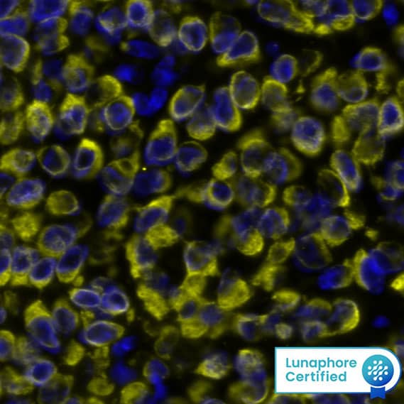 Cytokeratin, pan Antibody (AE-1/AE-3)