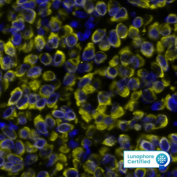 Cytokeratin, pan Antibody (AE-1/AE-3)