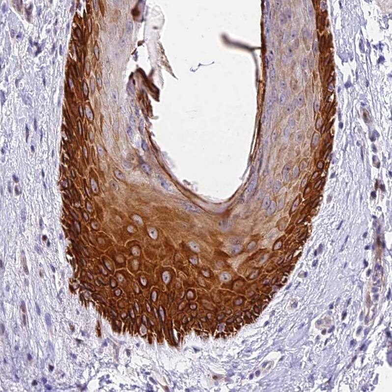 MIDN Antibody Immunohistochemistry-Paraffin: MIDN Antibody [NBP2-30387]