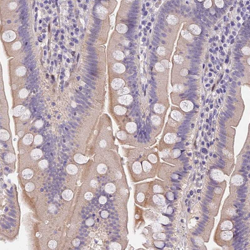 MIDN Antibody Immunohistochemistry-Paraffin: MIDN Antibody [NBP2-30387]