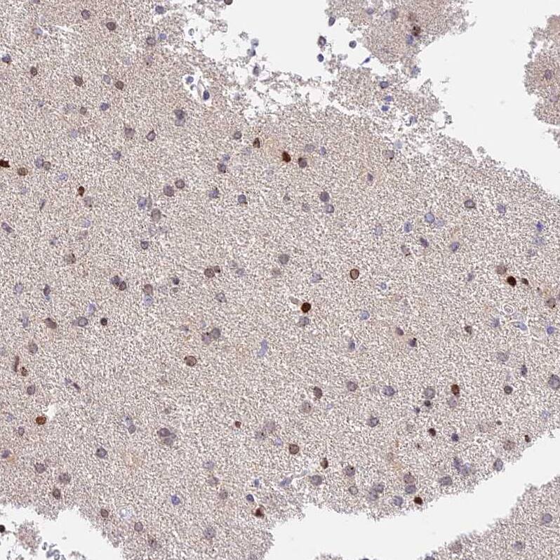 MIDN Antibody Immunohistochemistry-Paraffin: MIDN Antibody [NBP2-30387]