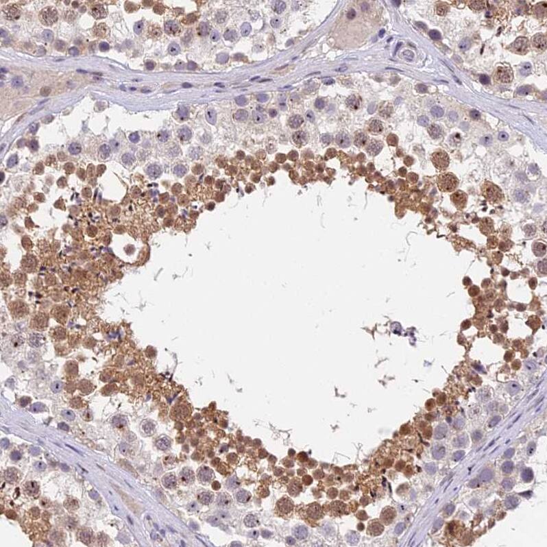 MIDN Antibody Immunohistochemistry-Paraffin: MIDN Antibody [NBP2-30387]