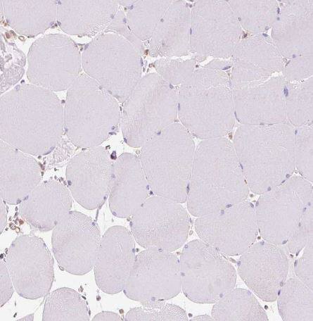 TBC1D2B Antibody