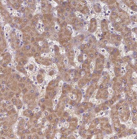 TM2D3 Antibody