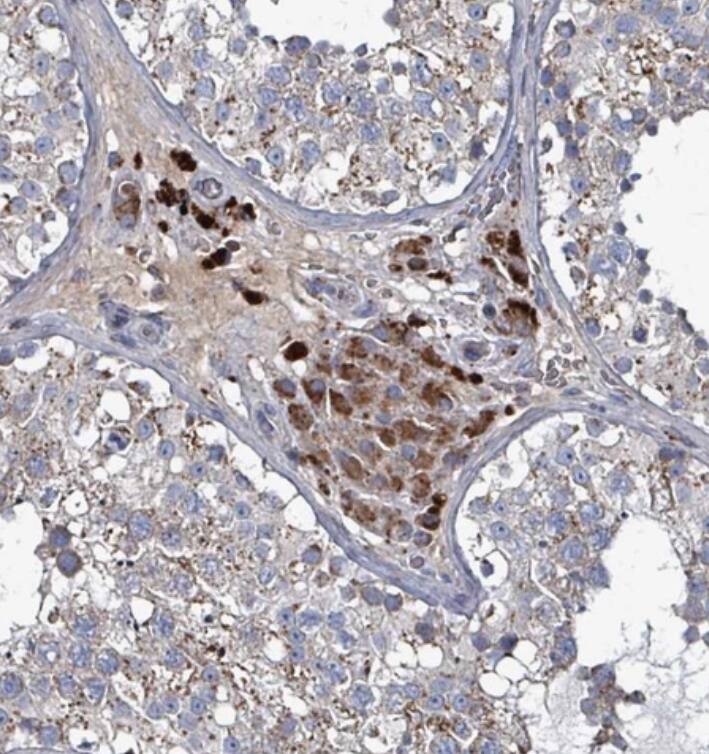 ABHD18 Antibody - BSA Free