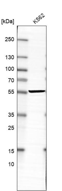 ABHD18 Antibody - BSA Free