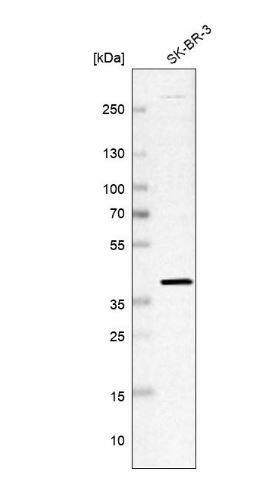 Replication Termination Factor 2 Antibody